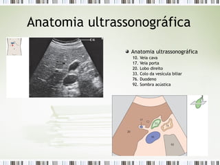 Anatomia ultrassonográfica
Anatomia ultrassonográfica
10. Veia cava
17. Veia porta
20. Lobo direito
33. Colo da vesícula biliar
76. Duodeno
92. Sombra acústica
 