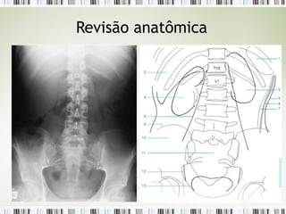 Revisão anatômica
 