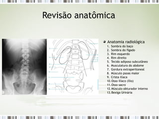Revisão anatômica
Anatomia radiológica
1. Sombra do baço
2. Sombra do fígado
3. Rim esquerdo
4. Rim direito
5. Tecido adiposo subcutâneo
6. Musculatura do abdome
7. Gordura extraperitoneal
8. Músculo psoas maior
9. Crista ilíaca
10.Osso ilíaco (ílio)
11.Osso sacro
12.Músculo obturador interno
13.Bexiga Urinária
 