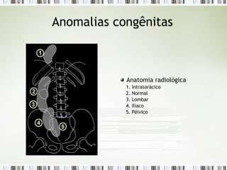 Anomalias congênitas
Anatomia radiológica
1. Intratorácico
2. Normal
3. Lombar
4. Ilíaco
5. Pélvico
1
2
3
4
5
 