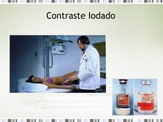 Contraste Iodado
 