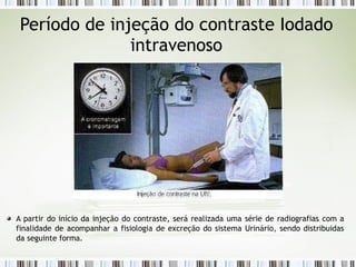 Período de injeção do contraste Iodado
intravenoso
A partir do início da injeção do contraste, será realizada uma série de radiografias com a
finalidade de acompanhar a fisiologia de excreção do sistema Urinário, sendo distribuidas
da seguinte forma.
 