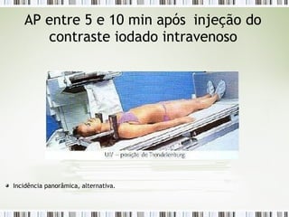 AP entre 5 e 10 min após injeção do
contraste iodado intravenoso
Incidência panorâmica, alternativa.
 