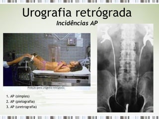 Urografia retrógrada
Incidências AP
1. AP (simples)
2. AP (pielografia)
3. AP (uretrografia)
 