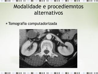 Modalidade e procediemntos
alternativos
Tomografia computadorizada
 