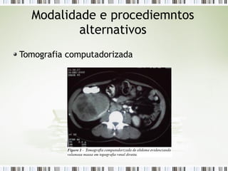 Modalidade e procediemntos
alternativos
Tomografia computadorizada
 