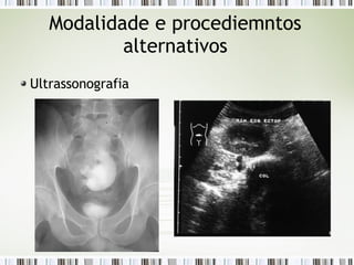 Modalidade e procediemntos
alternativos
Ultrassonografia
 