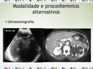 Modalidade e procediemntos
alternativos
Ultrassonografia
 