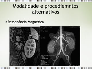 Modalidade e procediemntos
alternativos
Ressonância Magnética
 