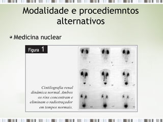 Modalidade e procediemntos
alternativos
Medicina nuclear
 
