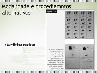 Modalidade e procediemntos
alternativos
Medicina nuclear
 