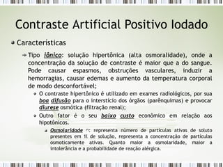 Contraste Artificial Positivo Iodado
Características
Tipo iônico: solução hipertônica (alta osmoralidade), onde a
concentração da solução de contraste é maior que a do sangue.
Pode causar espasmos, obstruções vasculares, induzir a
hemorragias, causar edemas e aumento da temperatura corporal
de modo desconfortável;
O contraste hipertônico é utilizado em exames radiológicos, por sua
boa difusão para o interstício dos órgãos (parênquimas) e provocar
diurese osmótica (filtração renal);
Outro fator é o seu baixo custo econômico em relação aos
hipotônicos.
Osmolaridade (*)
: representa número de partículas ativas de soluto
presentes em 1l de solução, representa a concentração de partículas
osmoticamente ativas. Quanto maior a osmolaridade, maior a
intolerância e a probabilidade de reação alérgica.
 
