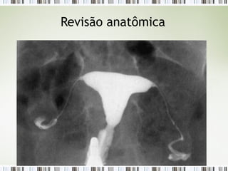 Revisão anatômica
 