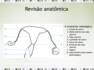 Revisão anatômica
Anatomia radiológica
1. Fundo do útero
2. Óstio uterino da tuba
uterina
3. Tuba uterina
4. Cavidade do útero
5. Ístmo do útero
6. Fímbrias da tuba
uterina
7. Vagina
8. Instrumento para exame
ginecológico
 