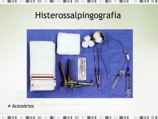 Histerossalpingografia
Acessórios
 