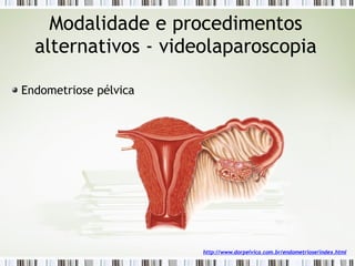Endometriose pélvica
Modalidade e procedimentos
alternativos - videolaparoscopia
http://www.dorpelvica.com.br/endometriose/index.html
 