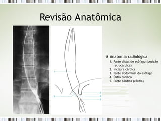 Revisão Anatômica
Anatomia radiológica
1. Parte distal do esôfago (posição
retrocárdica)
2. Incisura cárdica
3. Parte abdominal do esôfago
4. Óstio cárdico
5. Parte cárdica (cárdia)
 