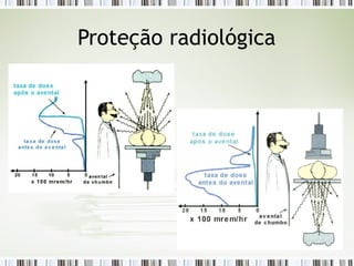 Proteção radiológica
 