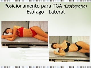 Posicionamento para TGA (Esofografia)
Esôfago – Lateral
 