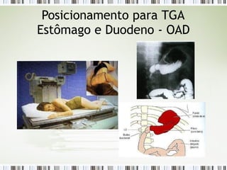 Posicionamento para TGA
Estômago e Duodeno - OAD
 