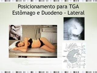 Posicionamento para TGA
Estômago e Duodeno - Lateral
 