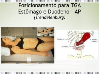 Posicionamento para TGA
Estômago e Duodeno – AP
(Trendelenburg)
 