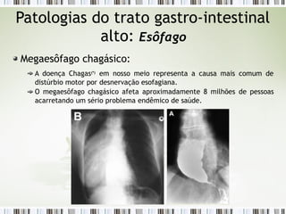 Patologias do trato gastro-intestinal
alto: Esôfago
Megaesôfago chagásico:
A doença Chagas(*)
em nosso meio representa a causa mais comum de
distúrbio motor por desnervação esofagiana.
O megaesôfago chagásico afeta aproximadamente 8 milhões de pessoas
acarretando um sério problema endêmico de saúde.
 