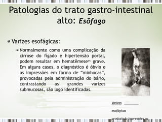 Patologias do trato gastro-intestinal
alto: Esôfago
Varizes esofágicas:
Normalmente como uma complicação da
cirrose do fígado e hipertensão portal,
podem resultar em hematêmese(*)
grave.
Em alguns casos, o diagnóstico é óbvio e
as impressões em forma de “minhocas”,
provocadas pela administração do bário,
contrastando as grandes varizes
submucosas, são logo identificadas.
Varizes
esofágicas
produzindo impressões na
 