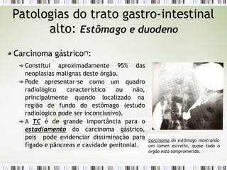Patologias do trato gastro-intestinal
alto: Estômago e duodeno
Carcinoma gástrico(*)
:
Constitui aproximadamente 95% das
neoplasias malígnas deste órgão.
Pode apresentar-se como um quadro
radiológico característico ou não,
principalmente quando localizado na
região de fundo do estômago (estudo
radiológico pode ser inconclusivo).
A TC é de grande importância para o
estadiamento do carcinoma gástrico,
pois pode evidenciar dissiminação para
fígado e pâncreas e cavidade peritonial.
Carcinoma do estômago mostrando
um lúmen estreito, quase todo o
órgão esta comprometido.
 