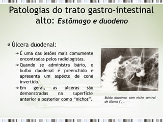 Patologias do trato gastro-intestinal
alto: Estômago e duodeno
Úlcera duodenal:
É uma das lesões mais comumente
encontradas pelos radiologistas.
Quando se administra bário, o
bulbo duodenal é preenchido e
apresenta um aspecto de cone
invertido.
Em geral, as úlceras são
demonstradas na superfície
anterior e posterior como “nichos”. Buldo duodenal com nicho central
de úlcera (*) .
 