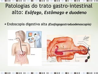 Patologias do trato gastro-intestinal
alto: Esôfago, Estômago e duodeno
Endoscopia digestiva alta (Esofagogastroduodenoscopia)
 