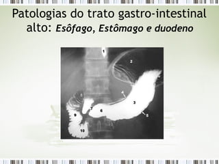 Patologias do trato gastro-intestinal
alto: Esôfago, Estômago e duodeno
 