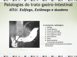 Patologias do trato gastro-intestinal
alto: Esôfago, Estômago e duodeno
Anatomia radiológica
1. Esôfago
2. Fundo gástrico
3. Corpo do estômago
4. Curva gástrica menor
5. Curva gástrica maior
6. Antro pilórico
7. Piloro
8. Bulbo duodenal
9.2a porção do duodeno
(descendente) 10.3a porção do duodeno
(horizontal)
 