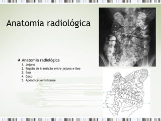 Anatomia radiológica
Anatomia radiológica
1. Jejuno
2. Região de transição entre jejuno e íleo
3. Íleo
4. Ceco
5. Apêndice vermiforme
 
