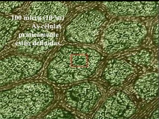 100 micra (10-4
m)
As células
praticamente
estão definidas.
 