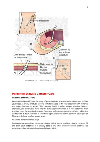 9
Peritoneal Dialysis Catheter Care
GENERAL INFORMATION:
Peritoneal dialysis (PD) uses the lining of your abdomen (the peritoneal membrane) to filter
your blood. A small, soft tube called a catheter is used to fill your abdomen with minerals
and sugar dissolved in water. This cleansing liquid is called dialysis solution. Wastes,
chemicals, and extra water move into the dialysis solution while it is in your abdomen. After
a certain time, the solution is drained from your abdomen through the catheter, taking the
wastes with it. Your abdomen is then filled again with new dialysis solution. Each cycle of
filling and draining is called an exchange.
PD can be done in different ways.
Continuous cycler-assisted peritoneal dialysis (CCPD) uses a machine called a cycler to fill
and drain your abdomen. It is usually done a few times while you sleep. CCPD is also
sometimes called automated peritoneal dialysis (APD).
 