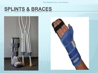 SPLINTS & BRACES
Mrs. Babitha K Devu, Asstt. Professor
 