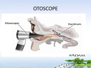 OTOSCOPE
 