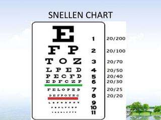 SNELLEN CHART
 