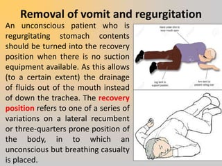 Brief Note On Maintaining Patent Airway | PPTX