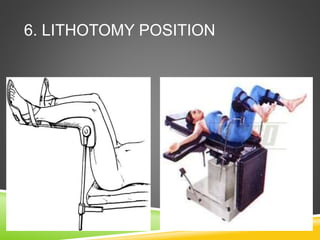 6. LITHOTOMY POSITION
 