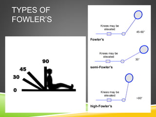 TYPES OF
FOWLER’S
 