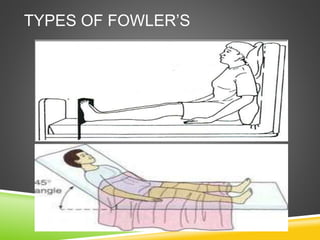 TYPES OF FOWLER’S
 