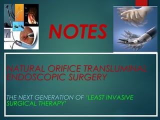 NOTES
NATURAL ORIFICE TRANSLUMINAL
ENDOSCOPIC SURGERY
THE NEXT GENERATION OF ‘LEAST INVASIVE
SURGICAL THERAPY’
NATURAL ORIFICE TRANSLUMINAL
ENDOSCOPIC SURGERY
THE NEXT GENERATION OF ‘LEAST INVASIVE
SURGICAL THERAPY’
 