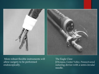  More robust flexible instruments will
allow surgery to be performed
endoscopically.
The Eagle Claw
[Olympus, Center Valley, Pennsylvania]
suturing device with a semi-circular
needle.
 