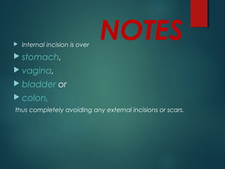 NOTES Internal incision is over
 stomach,
 vagina,
 bladder or
 colon,
thus completely avoiding any external incisions or scars.
 