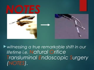 NOTES
witnessing a true remarkable shift in our
lifetime i.e. Natural Orifice
Transluminal Endoscopic Surgery
(NOTES).
 