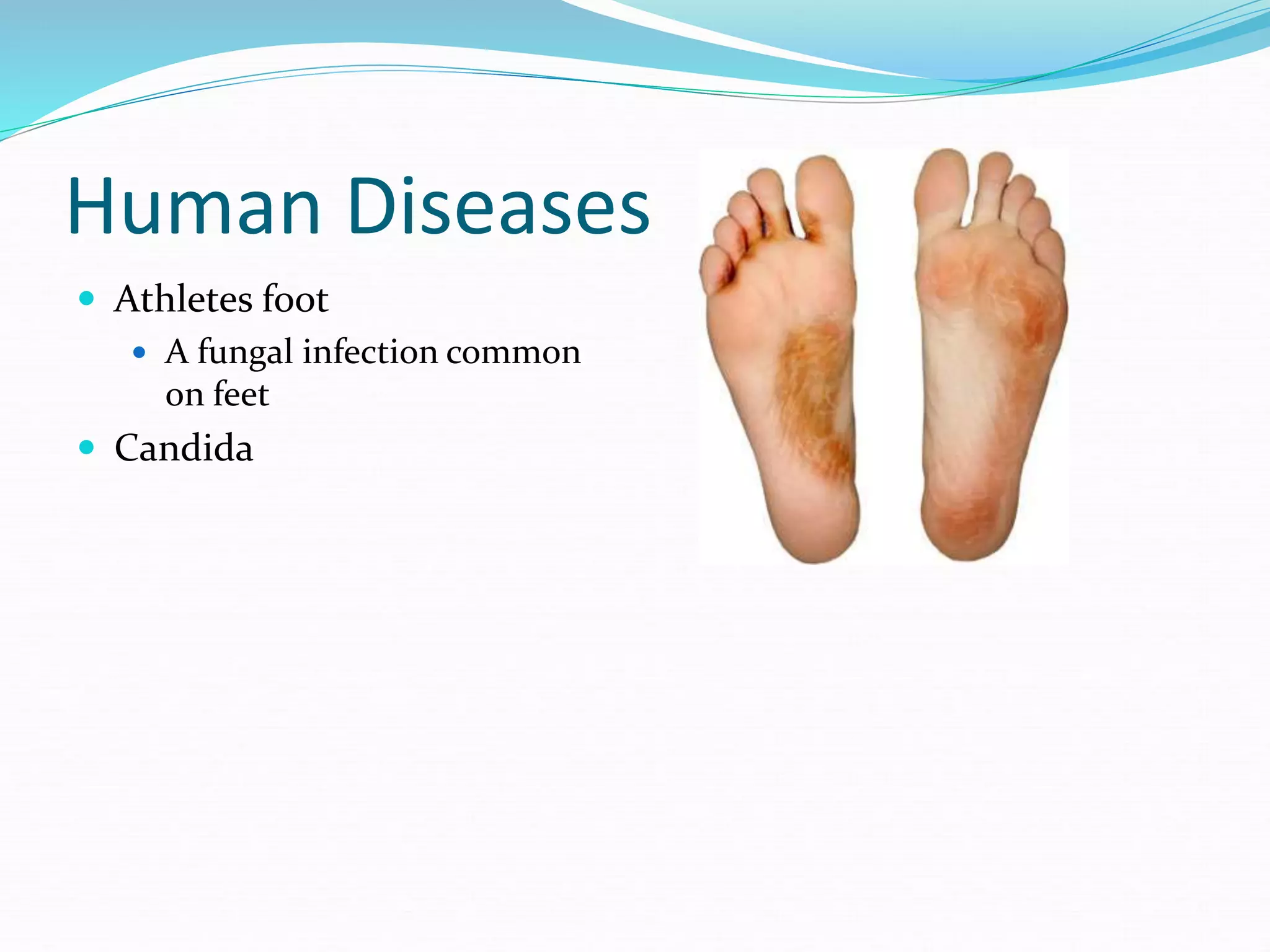 Human Diseases
 Athletes foot
 A fungal infection common
on feet
 Candida
 