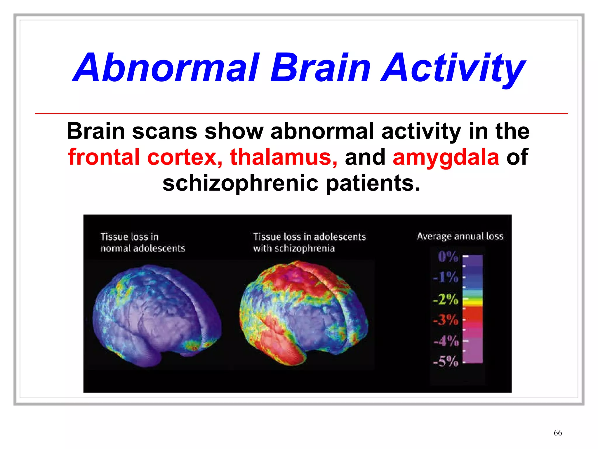 Abnormal Brain Activity Brain scans show abnormal activity in the  frontal cortex, thalamus,  and   amygdala  of schizophrenic patients.  
