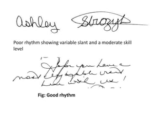 Poor rhythm showing variable slant and a moderate skill
level
Fig: Good rhythm
 